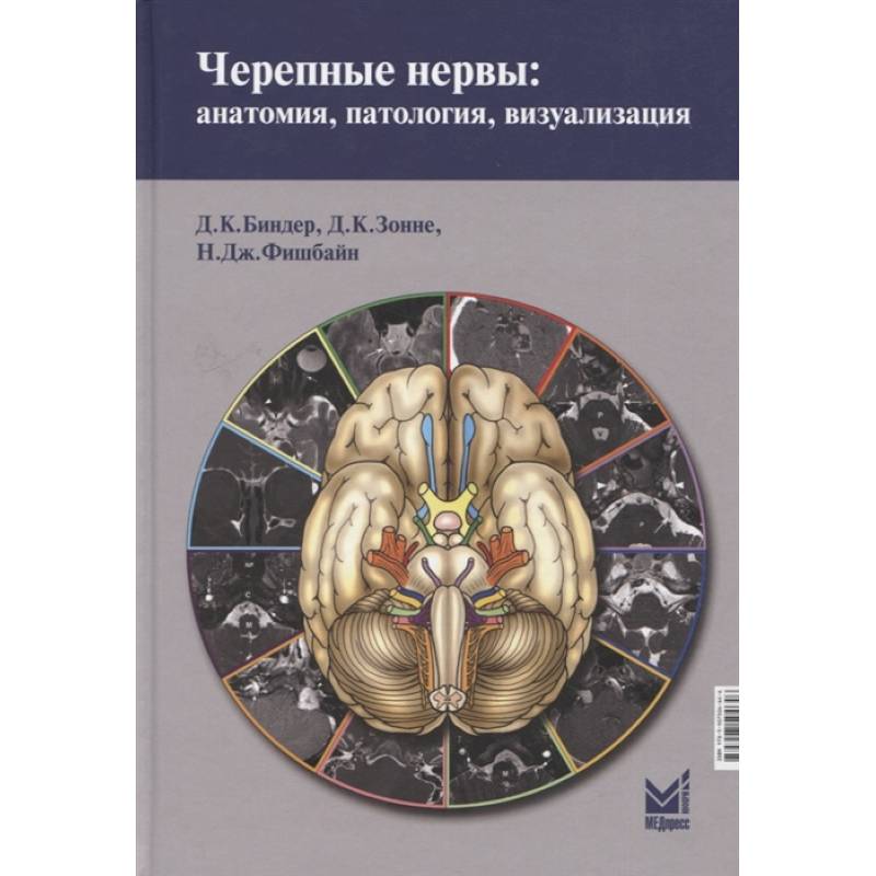 Фото Черепные нервы: анатомия, патология, визуализация