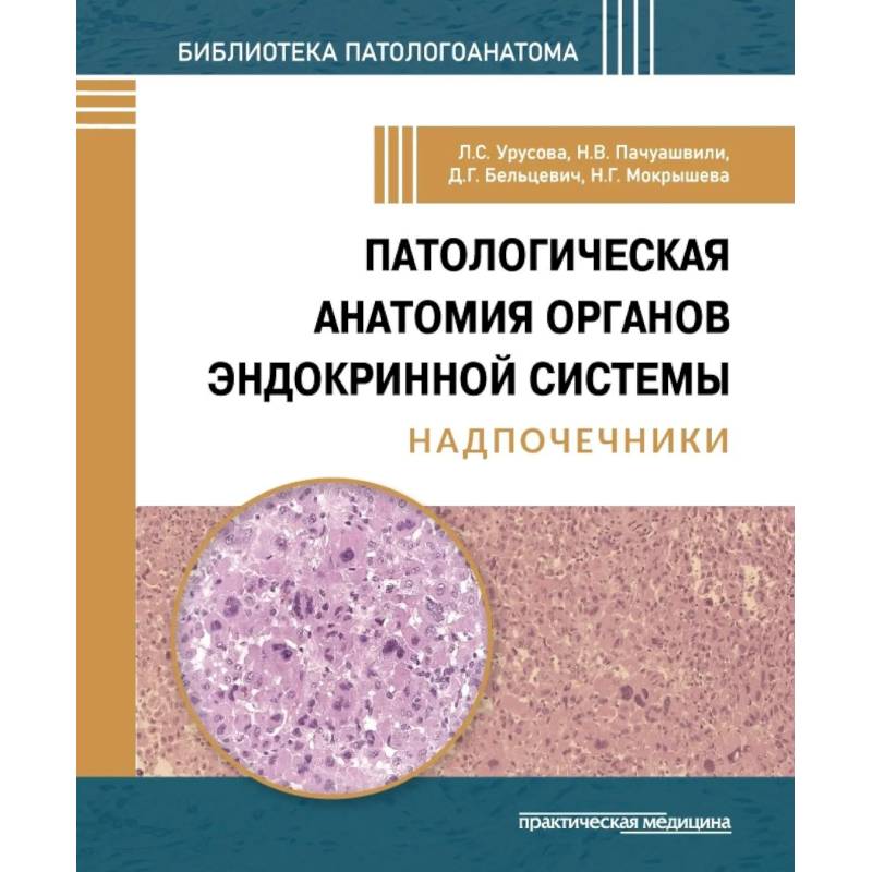 Фото Патологич анатомия органов эндокр сист.Надпочечник