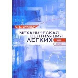 Фото Механическая вентиляция легких