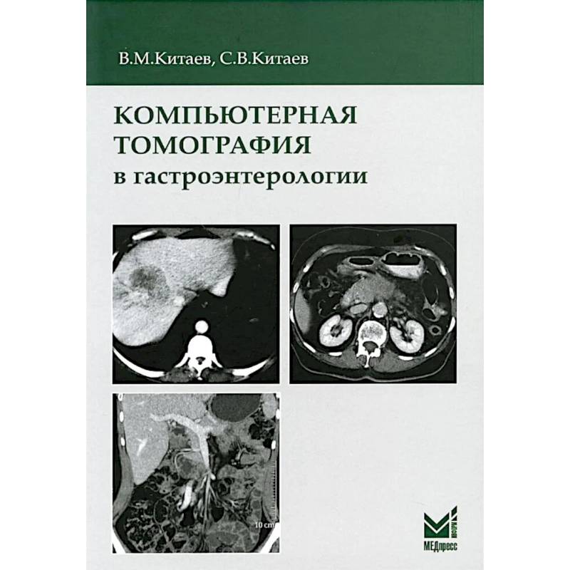 Фото Компьютерная томография в гастроэнтерологии: руководство для врачей.