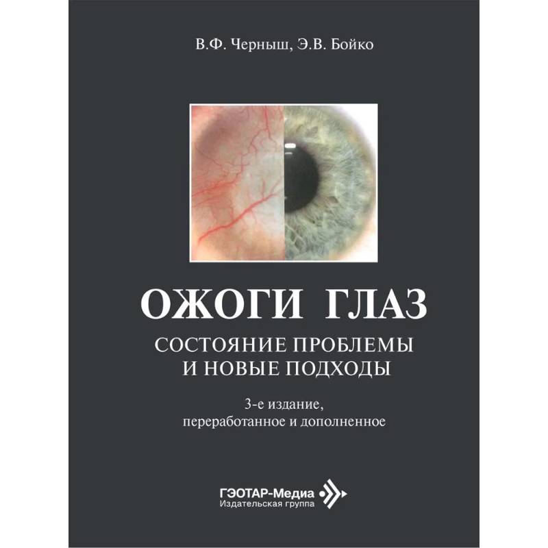 Фото Ожоги глаз. Состояние проблемы и новые подходы
