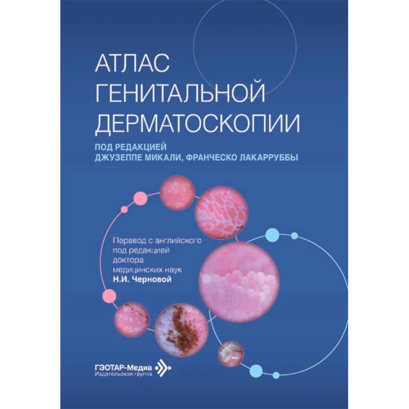 Фото Атлас генитальной дерматоскопии
