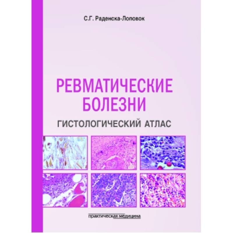 Фото Ревматические болезни. Гистологический атлас