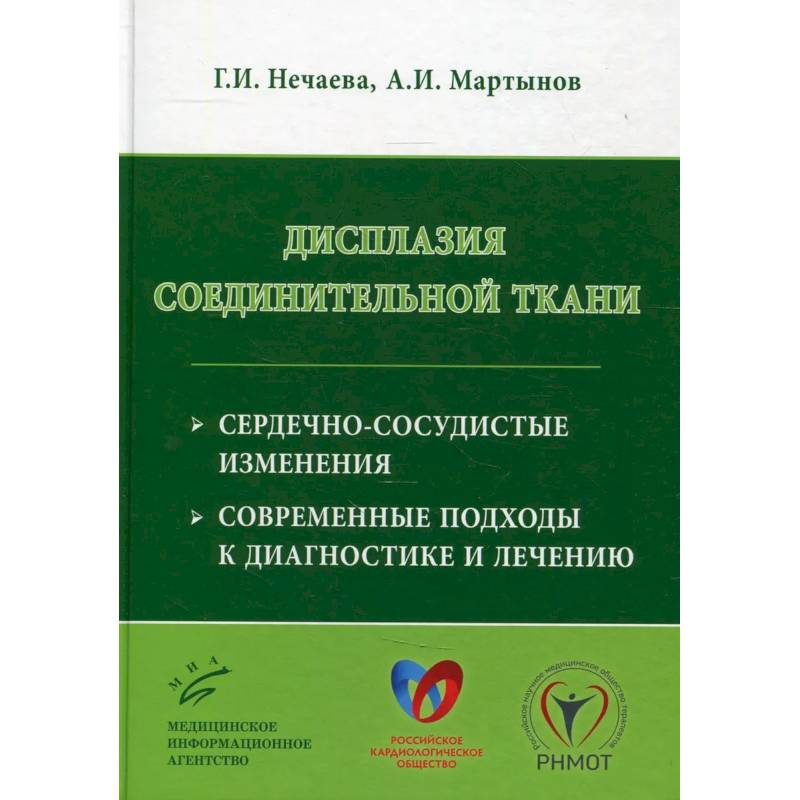 Фото Дисплазия соединительной ткани: сердечно-сосудистые изменения, современные подходы к диагностике и лечению