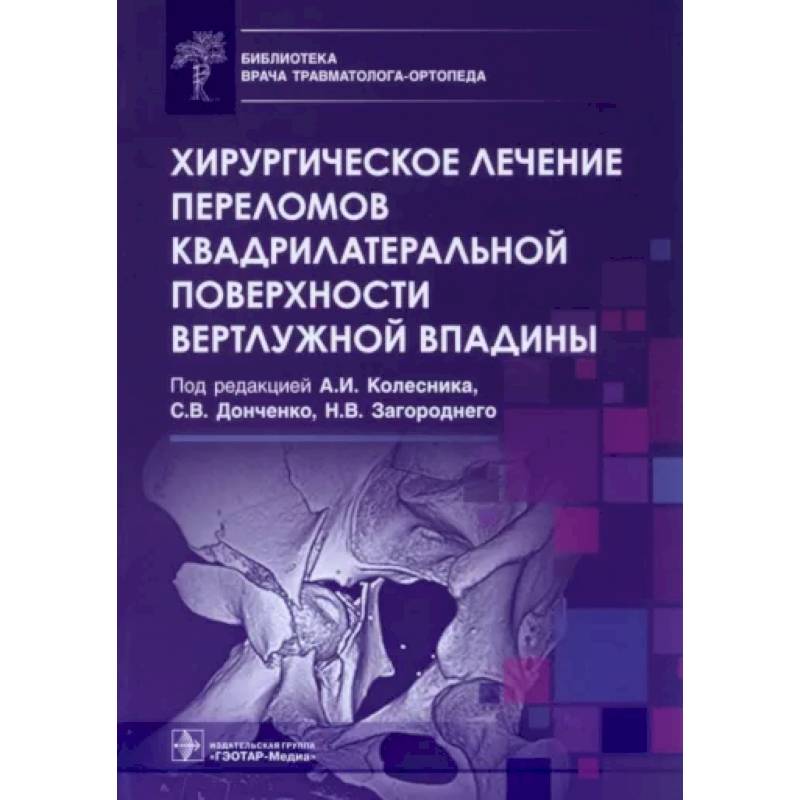 Фото Хирургическое лечение переломов квадрилатеральной поверхности вертлужной впадины