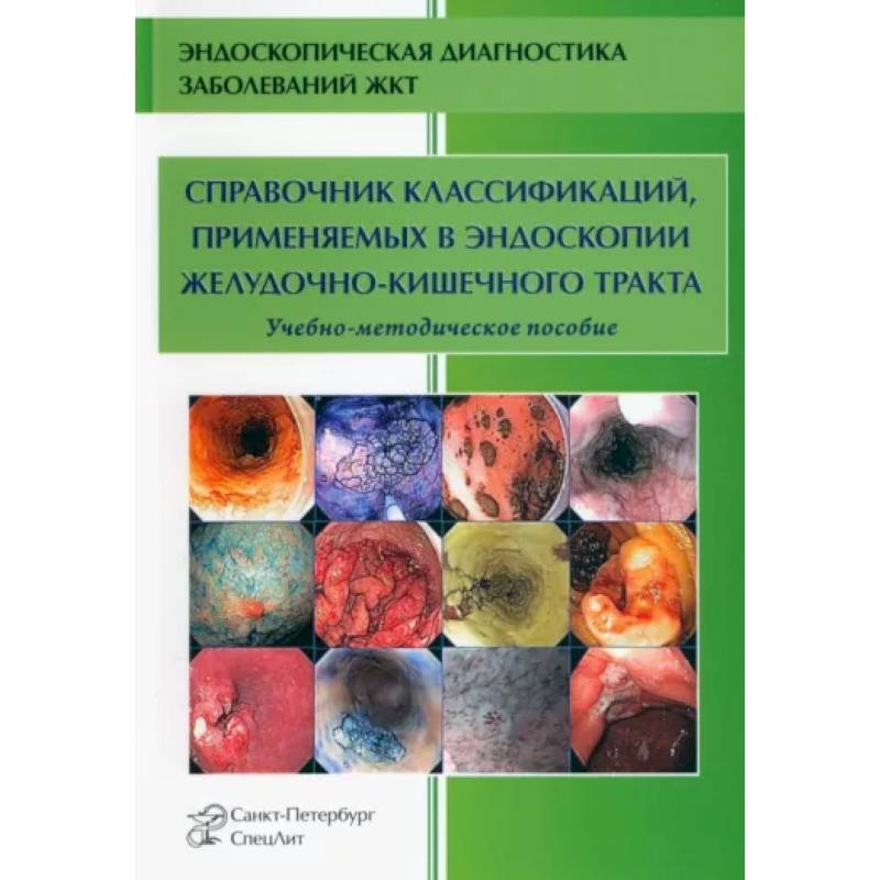Фото Справочник классификаций, применяемых в эндоскопии желудочно-кишечного тракта
