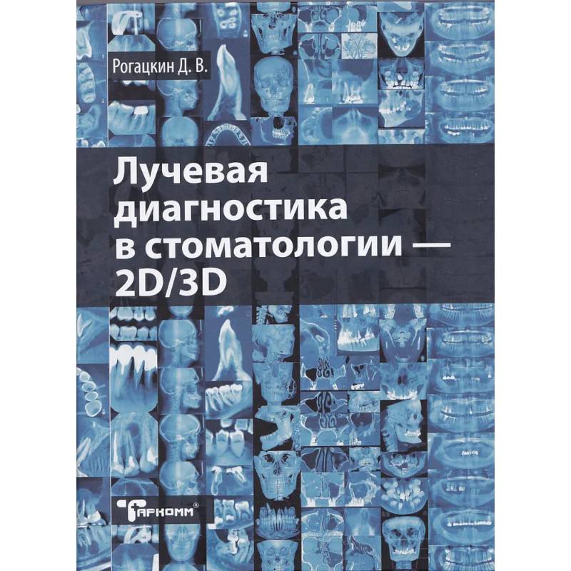 Фото Лучевая диагностика в стоматологии - 2D/3D