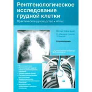 Фото Рентгенологическое исследование грудной клетки. Практическое руководство. Атлас