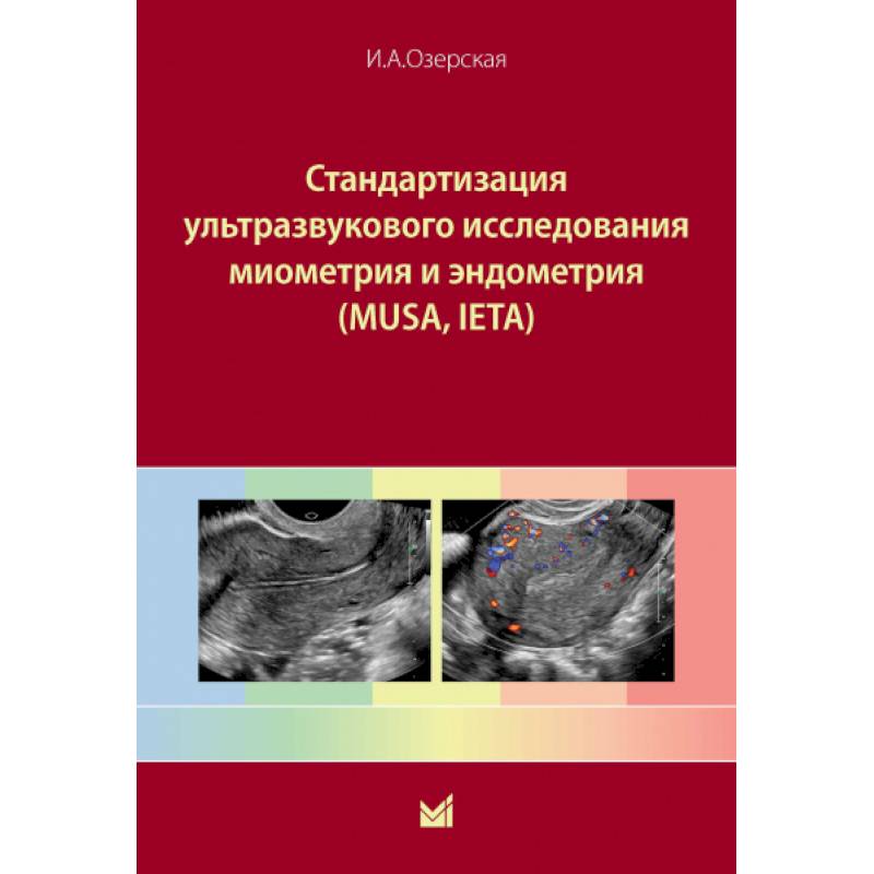 Фото Стандартизация ультразвукового исследования миометрия и эндометрия (MUSA, IETA)