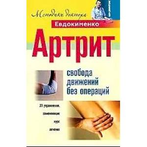 Фото Артрит. Свобода движений без операций