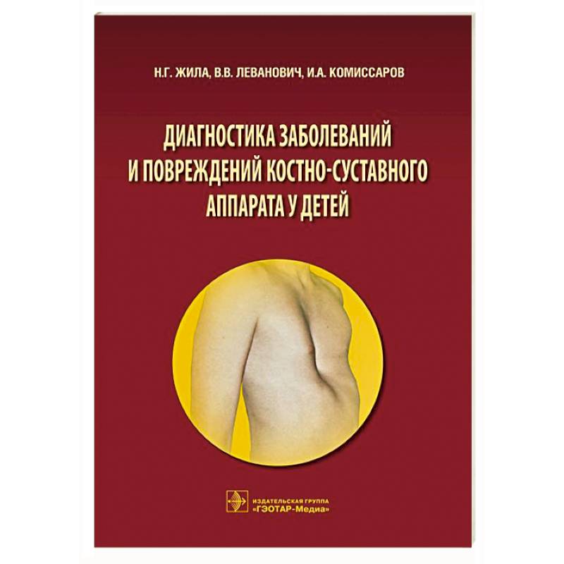 Фото Диагностика заболеваний и повреждений костно-суставного аппарата у детей