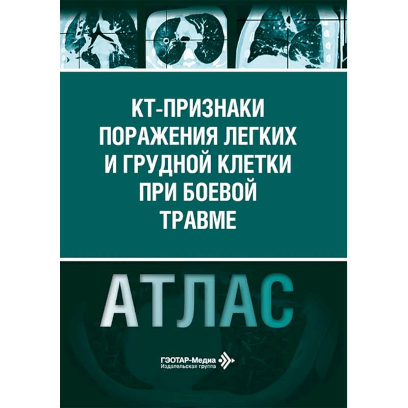 Фото КТ-признаки поражения легких и грудной клетки при боевой травме: атлас