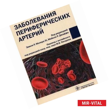 Фото Заболевания периферических артерий: руководство