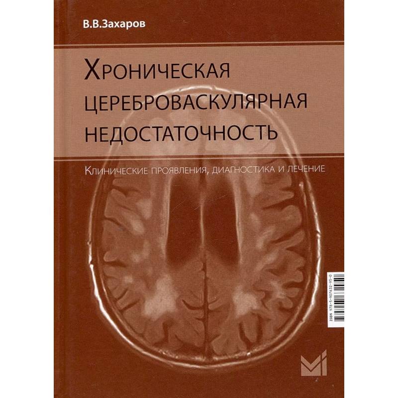 Фото Хроническая цереброваскулярная недостаточность