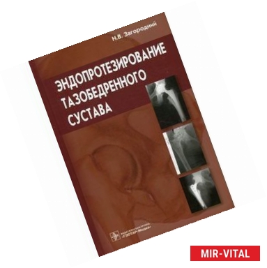 Фото Эндопротезирование тазобедренного сустава. Основы и практика: руководство