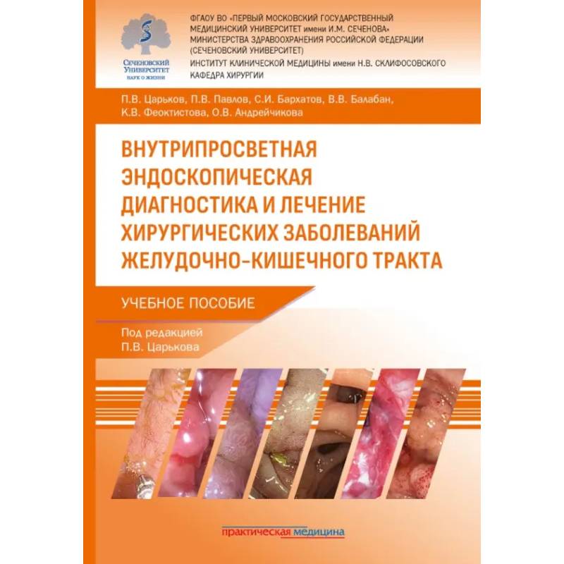Фото Внутрипросветная эндоскопическая диагностика и лечение хирургических заболеваний ЖКТ