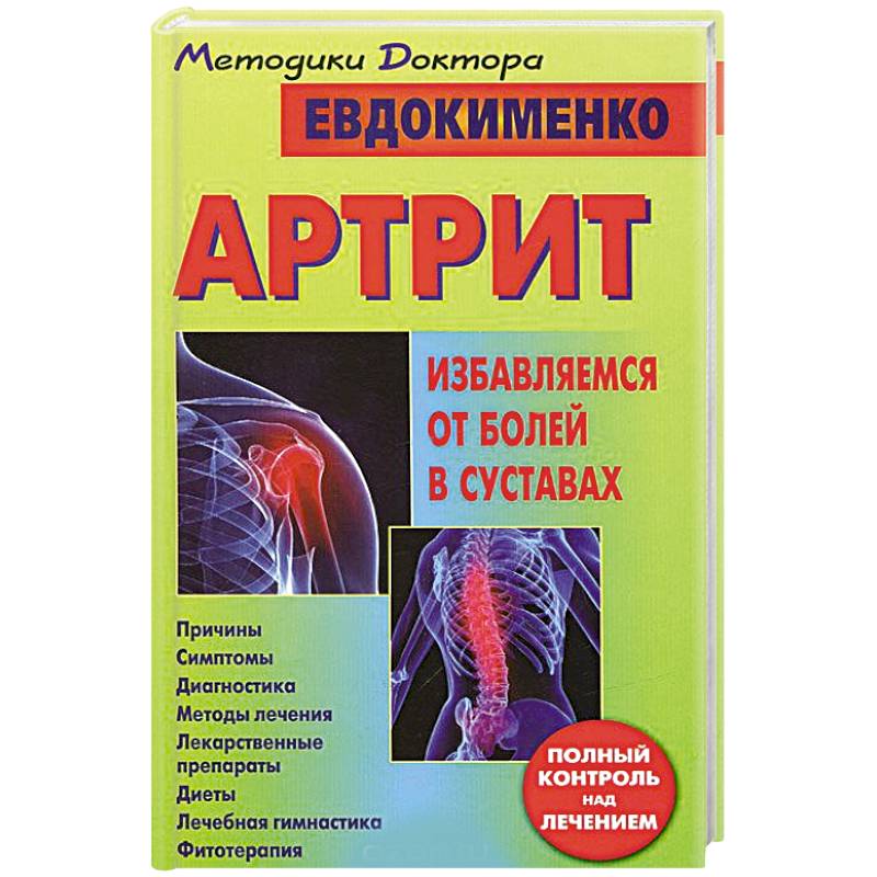 Фото Артрит. Избавляемся от болей в суставах
