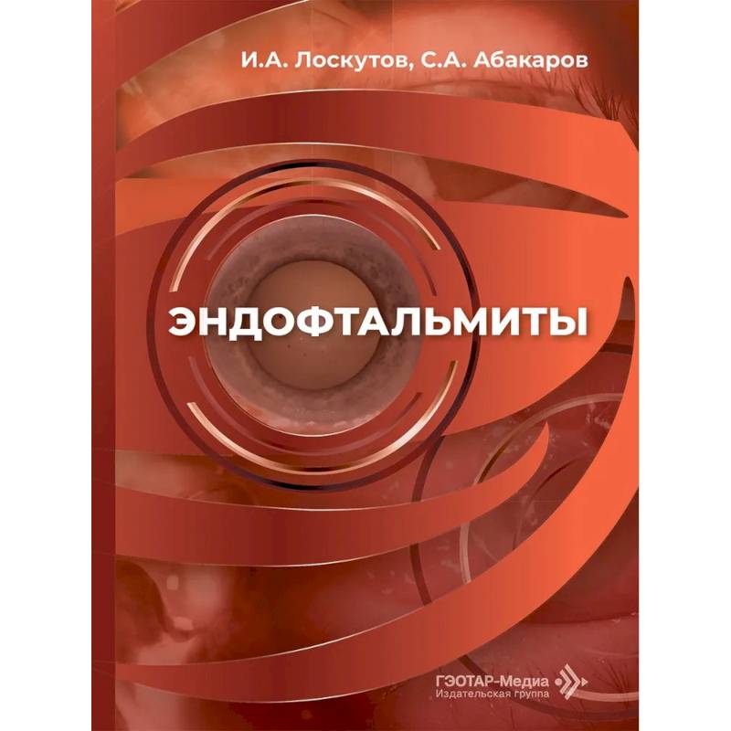 Фото Эндофтальмиты: руководство для врачей