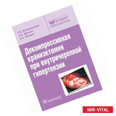 Фото Декомпрессивная краниэктомия при внутричерепной гипертензии