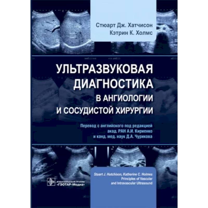 Фото Ультразвуковая диагностика в ангиологии и сосудистой хирургии