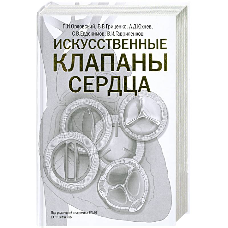 Фото Искусственные клапаны сердца