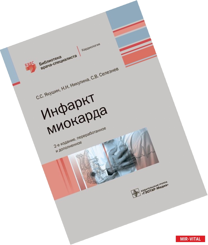 Фото Инфаркт миокарда