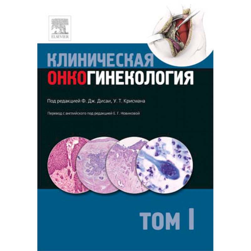 Фото Клиническая онкогинекология. В 3 томах. Том 1