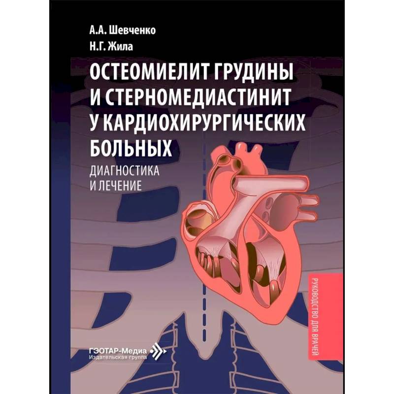 Фото Остеомиелит грудины и стерномедиастинит у кардиохирургических больных. Диагностика и лечение: руководство для врачей