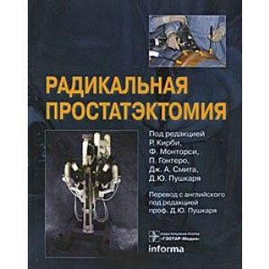 Фото Радикальная простатэктомия