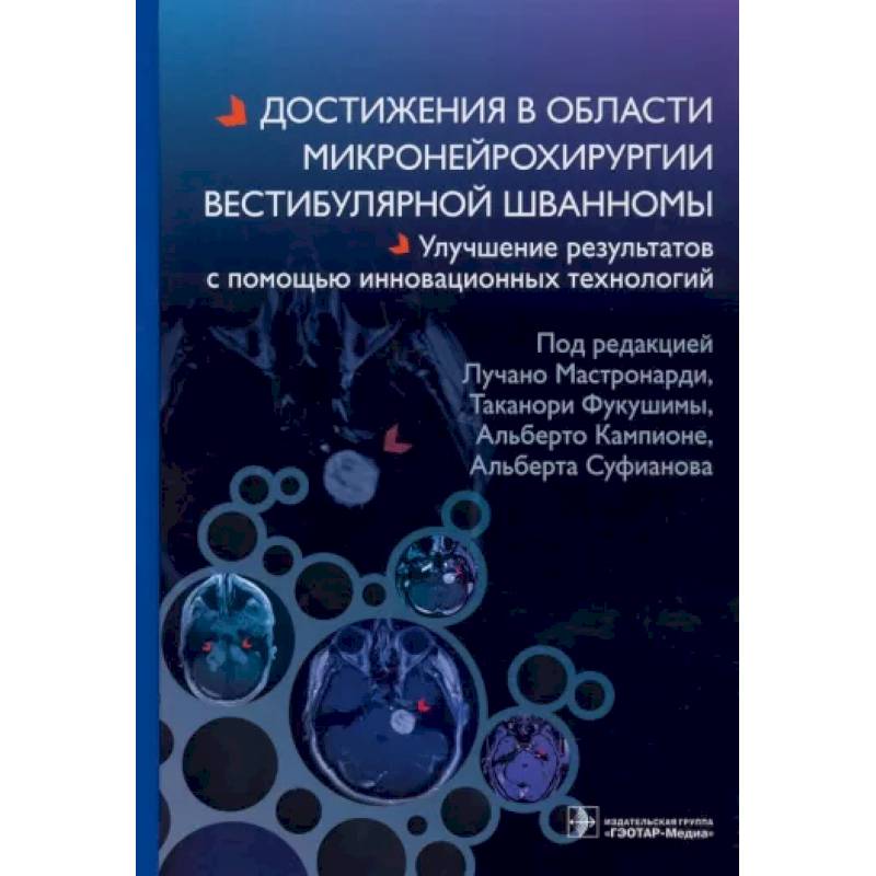 Фото Достижения в области микронейрохирургии вестибулярной шванномы