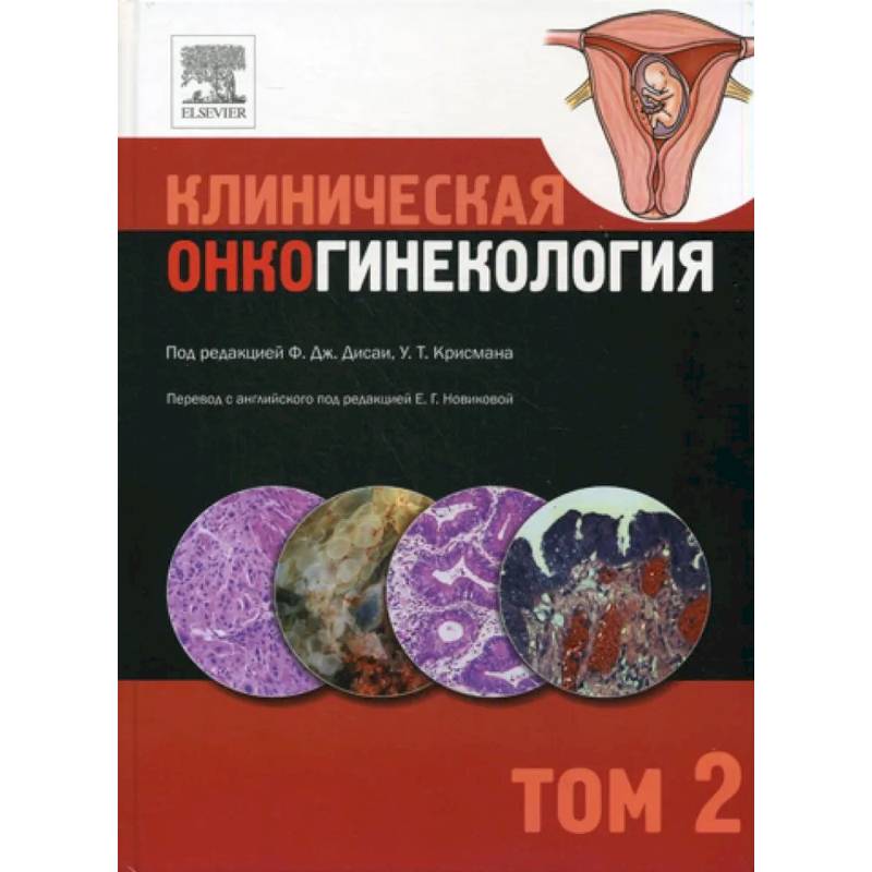 Фото Клиническая онкогинекология. В 3 томах. Том 2