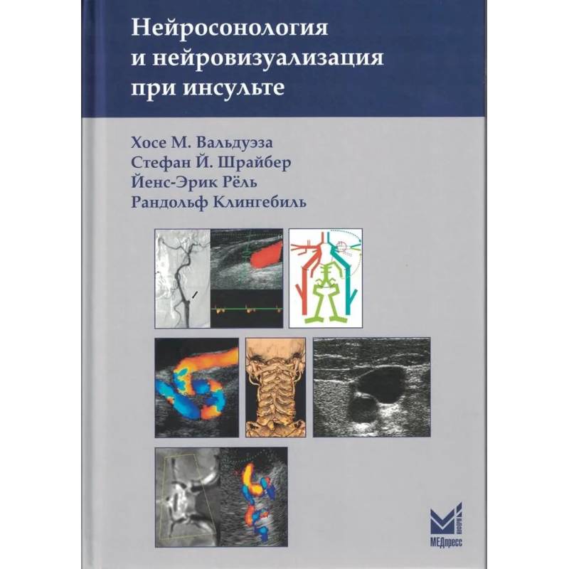 Фото Нейросонология и нейровизуализация при инсульте
