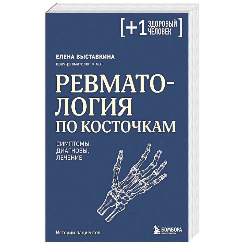 Фото Ревматология по косточкам. Симптомы, диагнозы, лечение