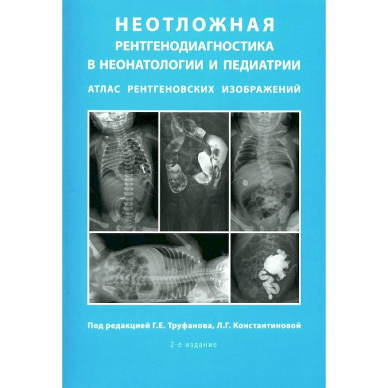 Фото Неотложная рентгенодиагностика в неонатологии и педиатрии. Атлас рентгеновских изображений. Учебное пособие