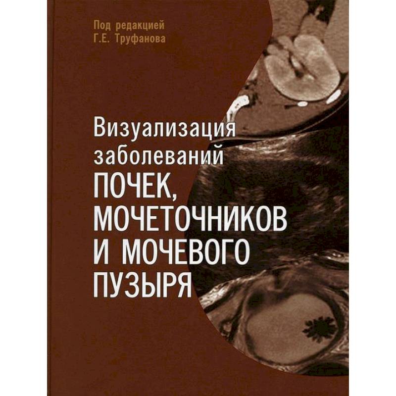 Фото Визуализация заболеваний почек, мочеточников и мочевого пузыря. Учебное пособие