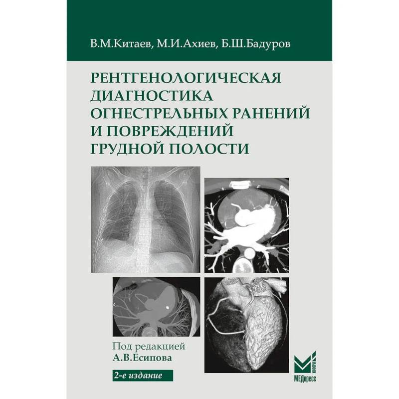Фото Рентгенологическая диагностика огнестрельных ранений и повреждений грудной полости