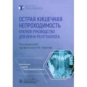 Фото Острая кишечная непроходимость. Краткое руководство для врача-рентгенолога