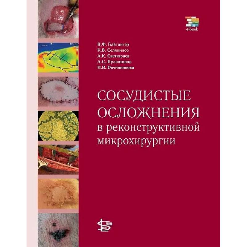 Фото Сосудистые осложнения в реконструктивной микрохирургии