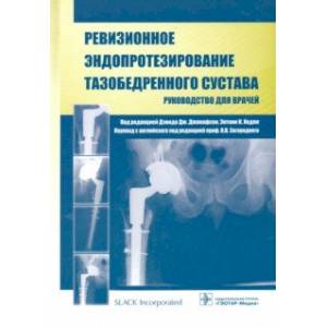 Фото Ревизионное эндопротезирование тазобедренного сустава. Руководство для врачей