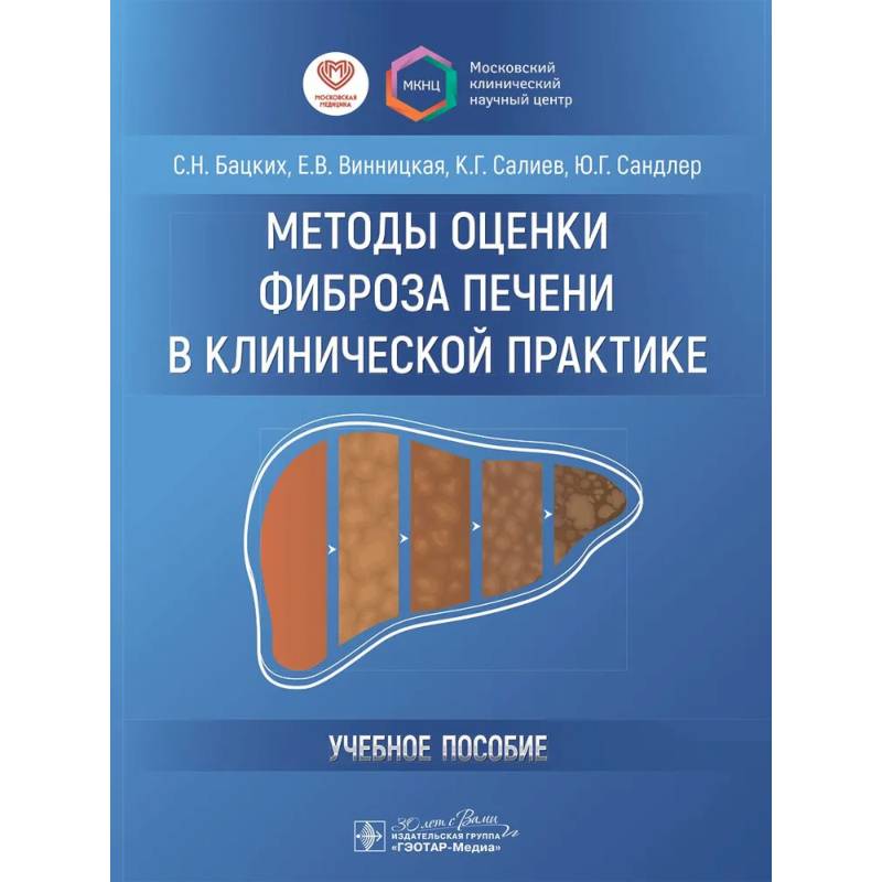 Фото Методы оценки фиброза печени в клинической практике