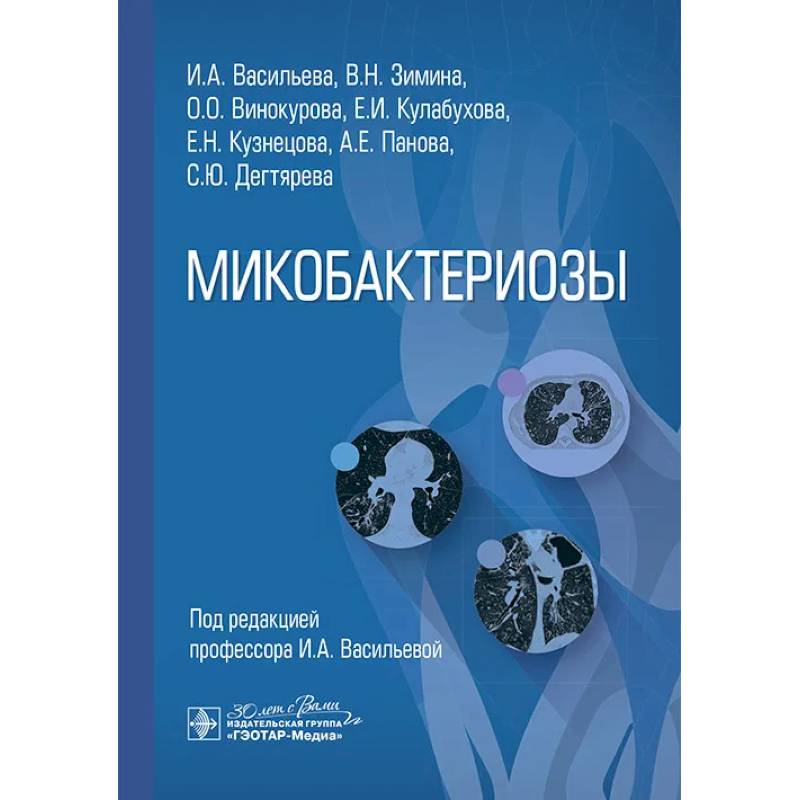 Фото Микобактериозы
