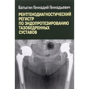 Фото Рентгенологический регистр по эндопротезированию тазобедренных суставов