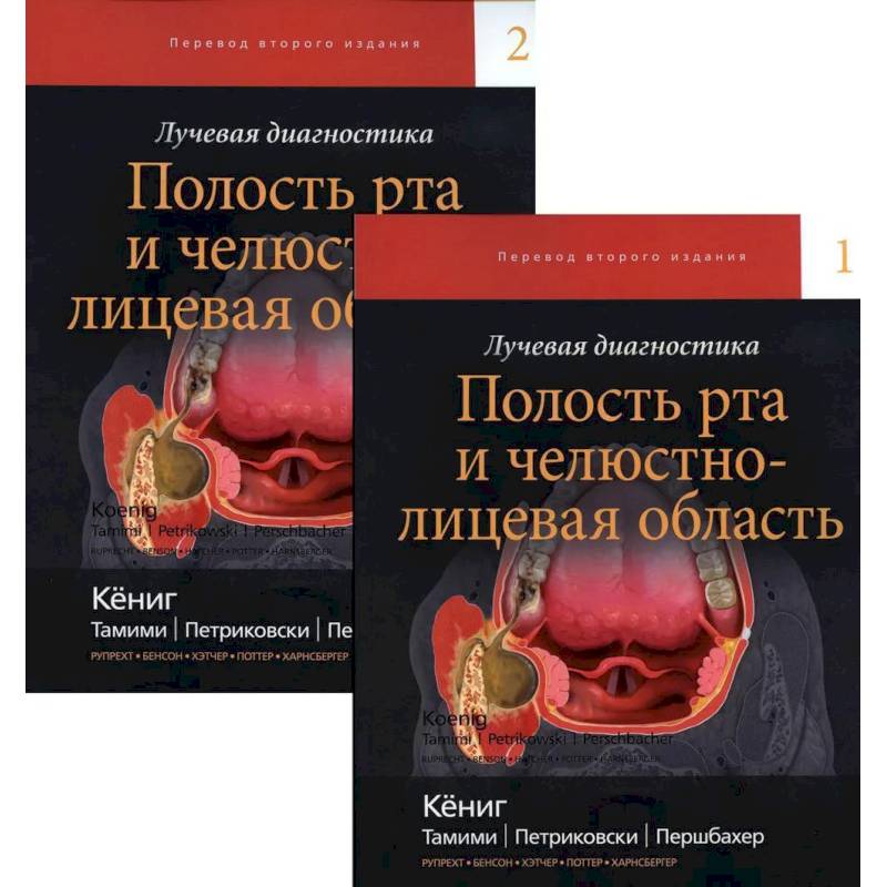Фото Лучевая диагностика. Полость рта и челюстно-лицевая область