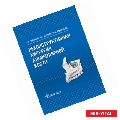 Фото Реконструктивная хирургия альвеолярной кости