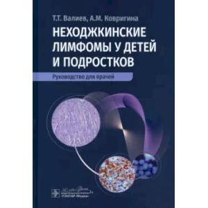 Фото Неходжкинские лимфомы у детей и подростков: руководство для врачей
