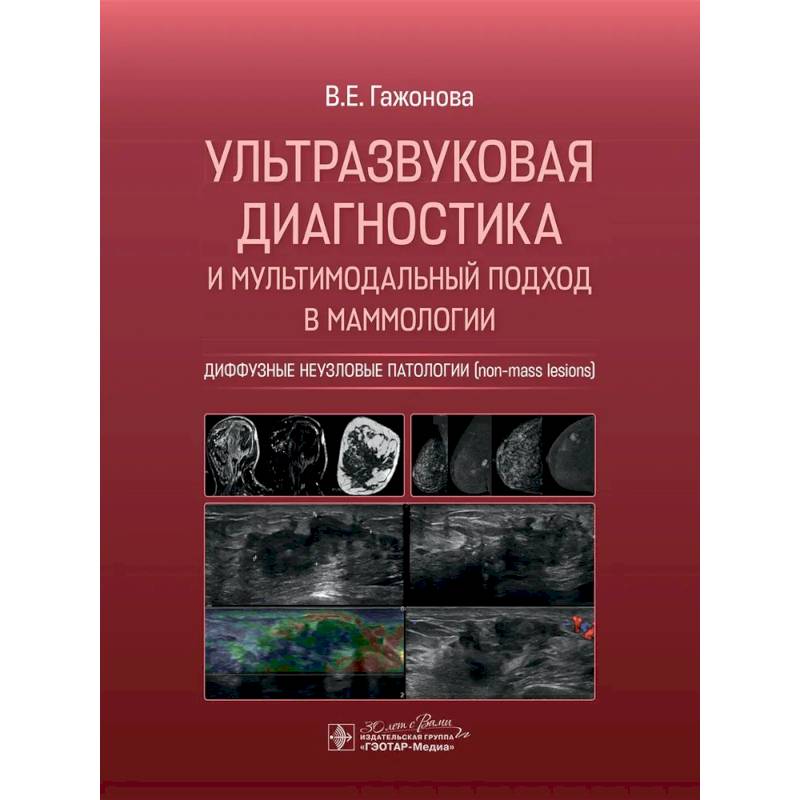 Фото Ультразвуковая диагностика и мультимодальный подход в маммологии. Диффузные неузловые патологии