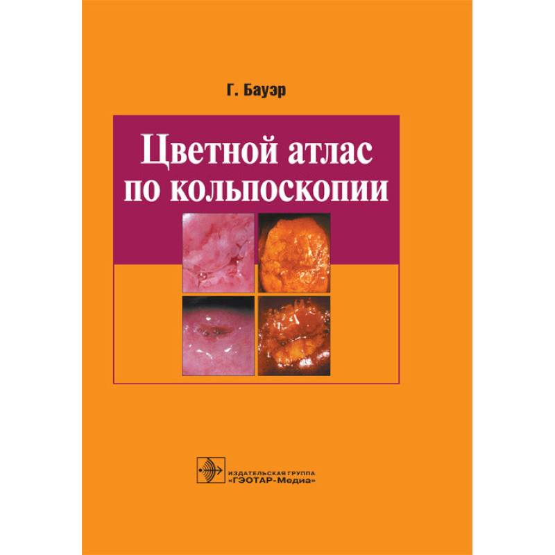 Фото Цветной атлас по кольпоскопии