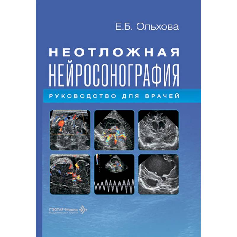 Фото Неотложная нейросонография: руководство для врачей