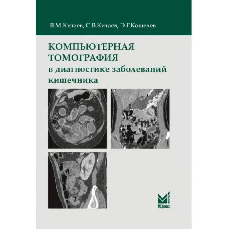 Фото Компьютерная томография в диагностике заболеваний кишечника