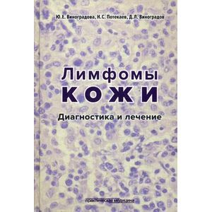 Фото Лимфомы кожи. Диагностика и лечение